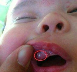 新生儿7个看似异常、其实正常的生理现象,你知道几个?建议收藏