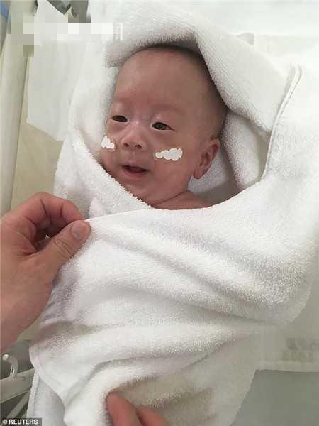 “世界最小男婴”出生时仅5个鸡蛋重，一年后，他的变化令人感叹