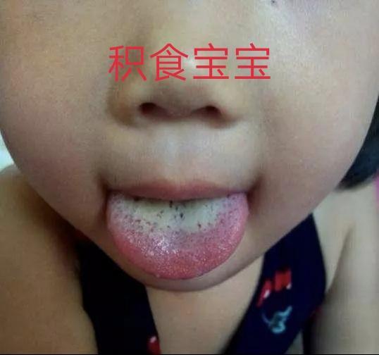 积食害处多，睡不好，脾气大，易咳嗽感冒，12大表现帮宝宝诊断