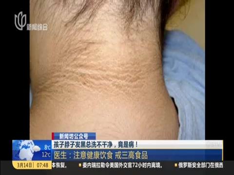 孩子脖子发黑总洗不干净，竟是病！医生：患病儿童日剧增加