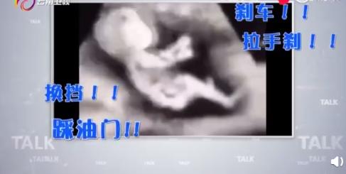 女司机做B超，胎儿在子宫内开车！你知道十个月里宝宝都干啥嘛？