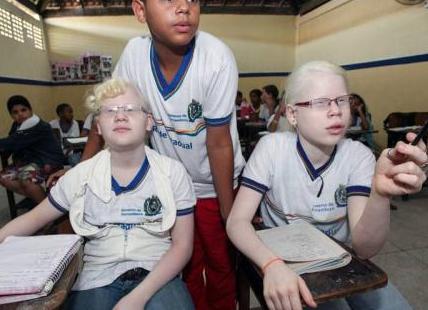 纯非洲父母却生出了三个白皮肤的孩子，常被误认为是人贩子