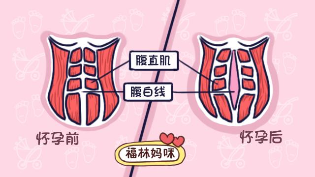 生完孩子肚子不见小，减肥后也只有肚子大？你想知道的这里都有