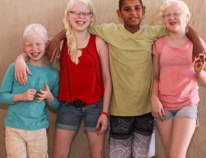 纯非洲父母却生出了三个白皮肤的孩子，常被误认为是人贩子