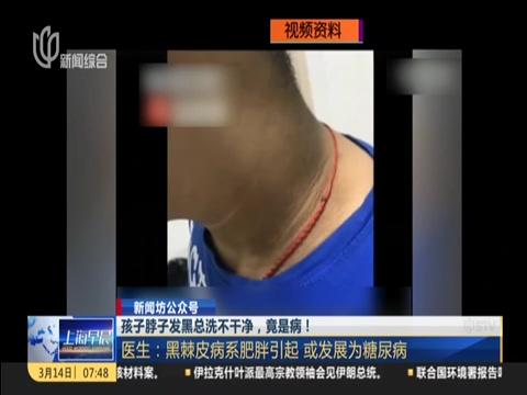 孩子脖子发黑总洗不干净，竟是病！医生：患病儿童日剧增加