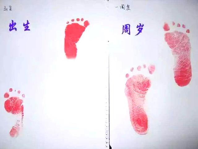 “为什么明星生娃晒脚印，我家娃没有”，医生不说，不代表真没有