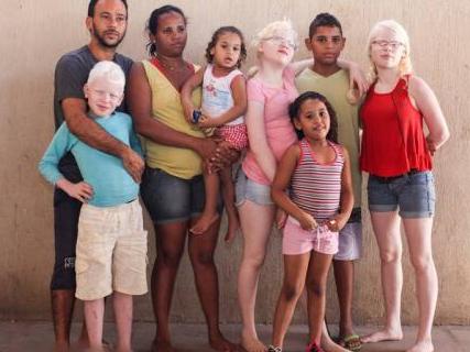 纯非洲父母却生出了三个白皮肤的孩子，常被误认为是人贩子