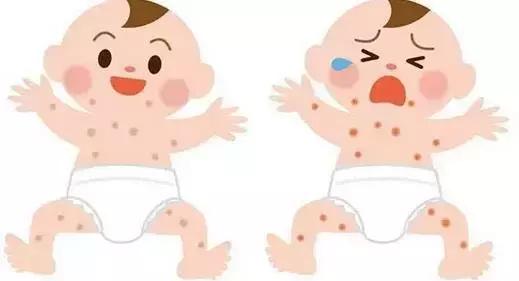 妈妈都会关心的宝宝如何预防护理皮肤干燥&湿疹？！