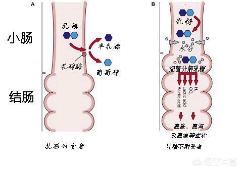 乳糖不耐受宝宝最常见的症状有哪些？