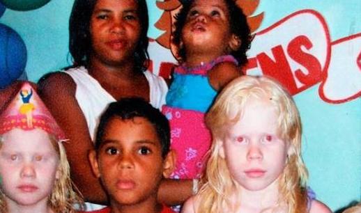 纯非洲父母却生出了三个白皮肤的孩子，常被误认为是人贩子