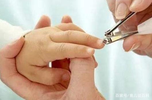 宝宝手上经常长倒刺，可能是身体缺了这个，妈妈别忽视了！