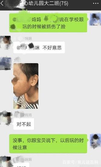 孩子学校回来脸被同学划伤，家长在群里一句玩笑话，结果事闹大了