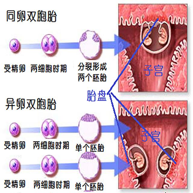 为什么会有双胞胎？哪些人易产下双胞胎？一起来聊聊双胞胎
