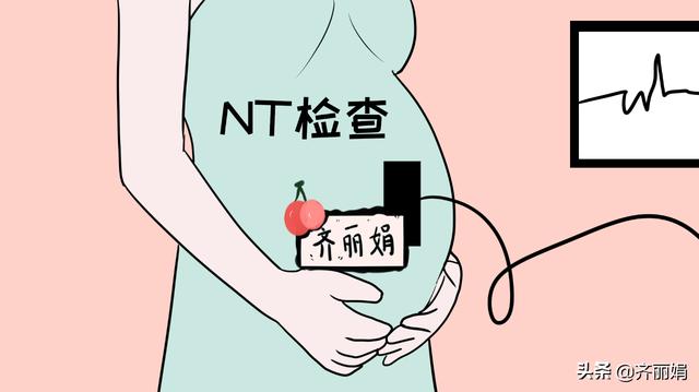 孕期必须要做的4个产检项目，孕妈们不可逃避，要按时产检
