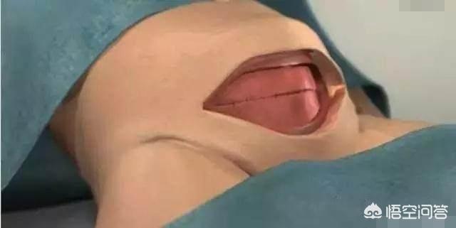 剖宫产要缝几层？