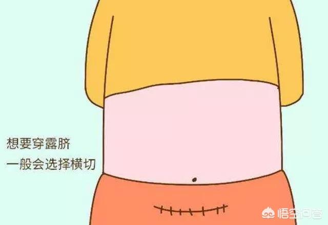 剖腹产横切口与竖切口有什么区别？选择哪种瘦身方式对产妇更健康？
