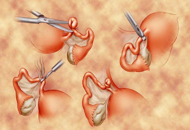 不孕不育选试管？不是逼不得已，没有哪位妈妈愿意承受这些伤痛！