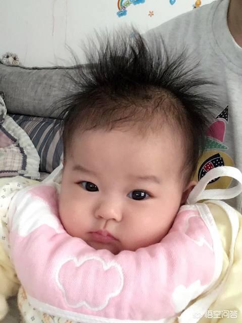 宝宝头发为什么竖着长？