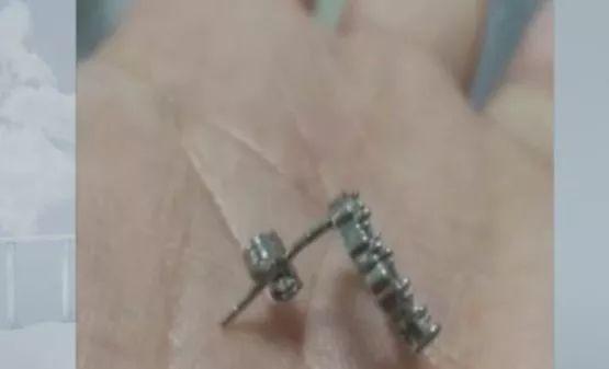 1岁宝宝哭闹，医生一看惊呆！妈妈身上这东西竟被他吞下
