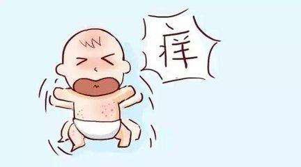 你与宝宝湿疹之间的较量，就缺这些必胜秘籍了！