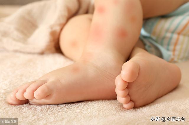 夏枯草熬水治疗婴幼儿湿疹4小时见效