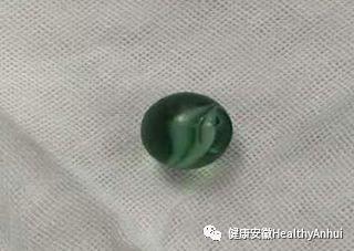 3岁女童下体取出玻璃球，专家支招应对孩子性“好奇”