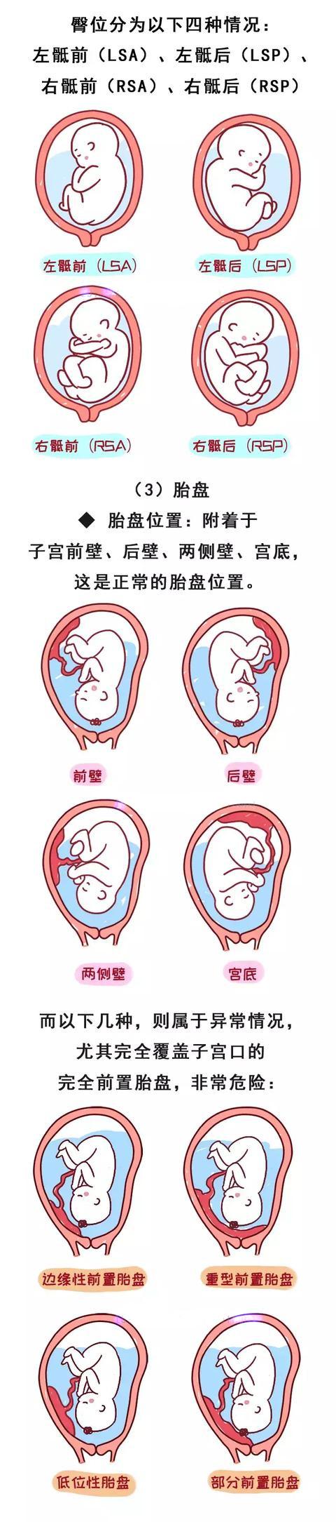 排队2小时，问诊1分钟？产检时你想知道的一篇搞定！