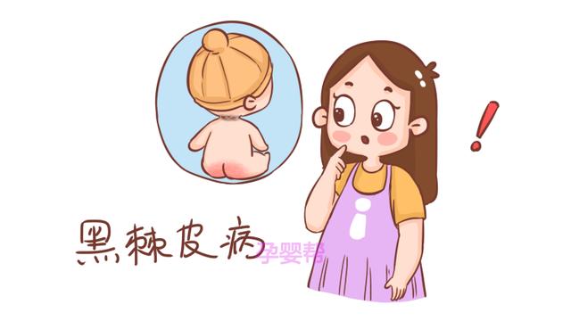 孩子脖子上有一圈黑怎么也洗不掉，去医院后才知道，都是家长的锅