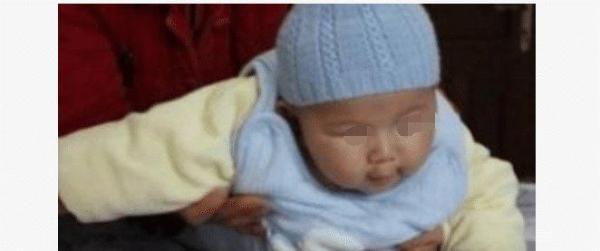 两个月婴儿被热水烫伤，孩子却不哭不闹，医生检查后，父母乐坏了