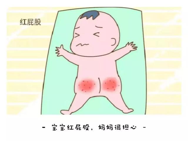 识物计划 | 正确选购宝宝护臀膏