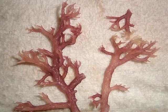 被美国七大注册营养师加入黑名单的卡拉胶，你还在吃？