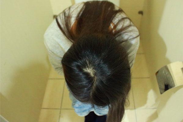 女孩第一次来月经在什么年龄最好？过早或过晚的，建议家长多留