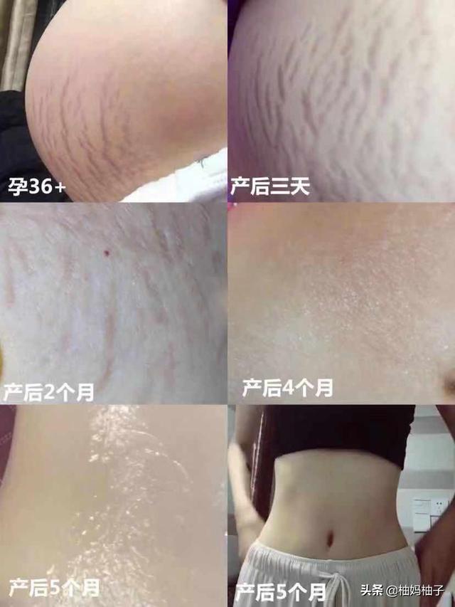 产后3个月黄金修复期，好好看一看，这样安排才靠谱！