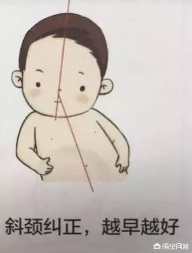 怎么判断五个月宝宝是不是斜颈？