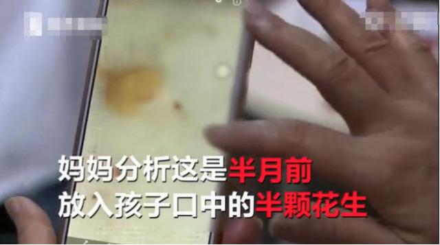 1岁宝宝气管被堵塞，眼睛翻白差点断气，元凶是家里的这个零食