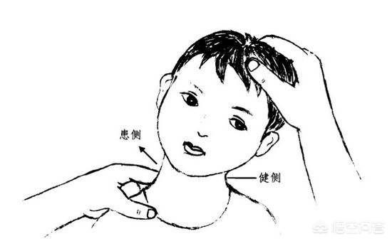 怎么判断五个月宝宝是不是斜颈？