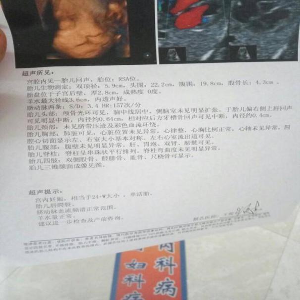 产检胎儿是兔唇，妈妈坚持把他生下，几个月后孩子变化令人惊喜