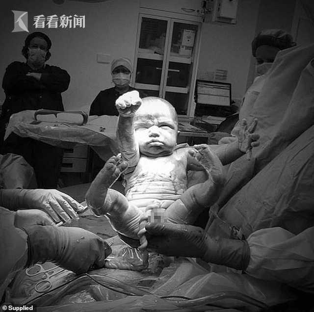 超人诞生！父亲拍下儿子出生一刻 男孩做出超人姿势