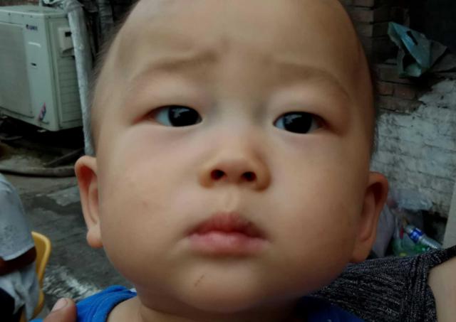 提醒：积食不只是影响吃饭，还有这些“信号”，家长别疏忽了！