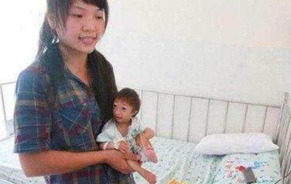 小夫妻不懂节制意外怀孕，生下孩子长成这样，马戏团出10万购买