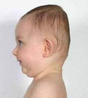 “扁头”宝宝遭小伙伴嘲笑，给新手爸妈敲响警钟啦