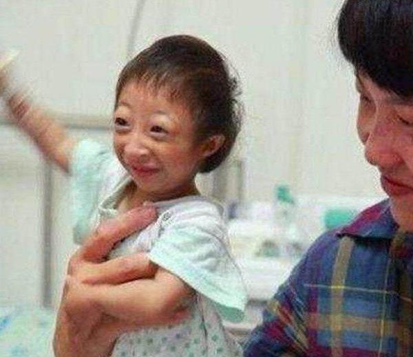 小夫妻不懂节制意外怀孕，生下孩子长成这样，马戏团出10万购买
