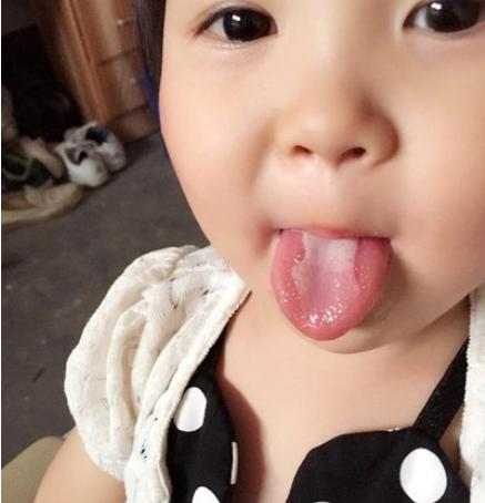 提醒：积食不只是影响吃饭，还有这些“信号”，家长别疏忽了！
