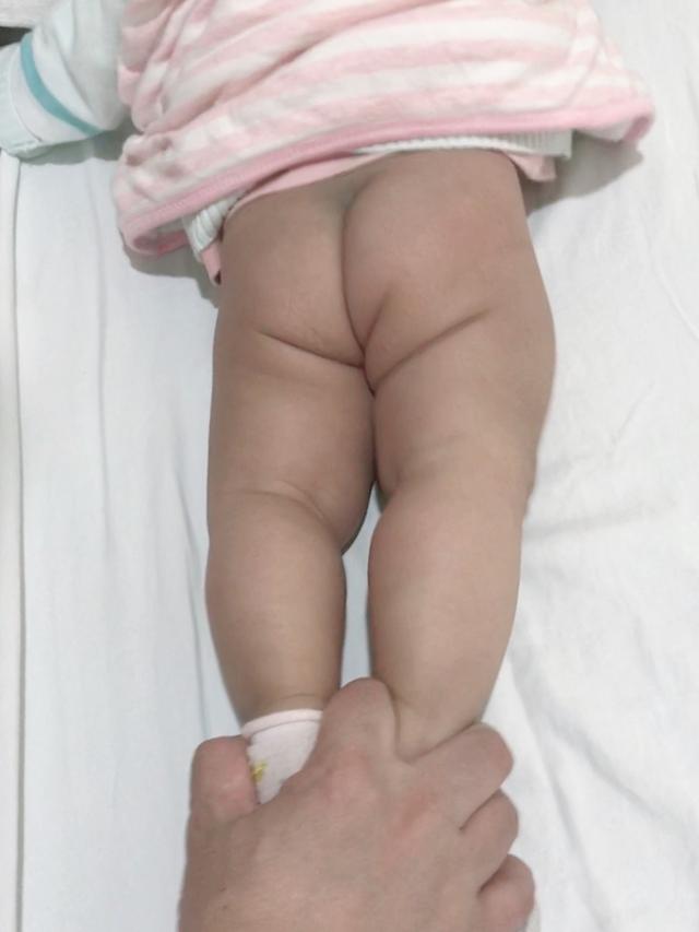 孩子走路像鸭子，可是现实没有卡通动画那么美好