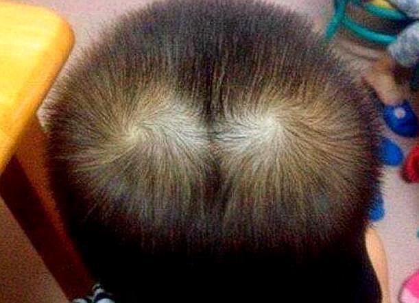 孩子头顶有2个旋，对性格有影响吗？听听过来人的说法！