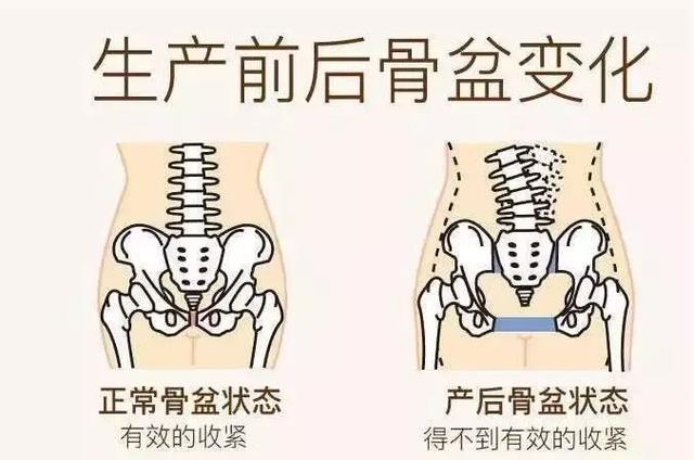 生完孩子腰酸背痛，很正常？错！这是身体受损伤了，得尽快治疗！