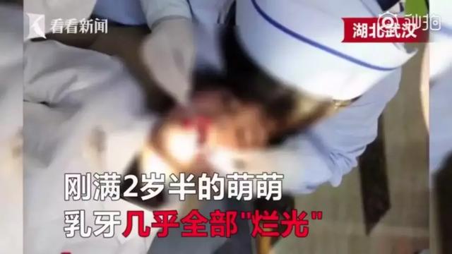 两岁宝宝乳牙全烂光！都怪家长这样喂