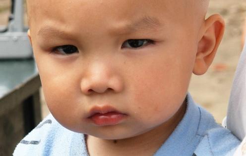 这些症状代表孩子的肚子里面有蛔虫，父母们注意到了吗？