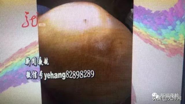 女子怀孕7个月浑然不知！医生一打开她的腹部，咦？孩子呢…