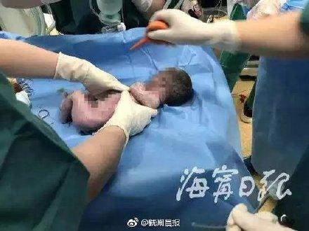 孕妇产子浑身抽搐，父亲放弃孩子前一句话让人泪崩：我想再看一眼我的孩子